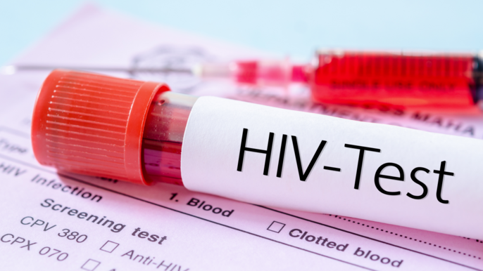 Miasto przekaże 10 tysięcy zł na bezpłatne, anonimowe badania na HIV - fot. CC0 license
