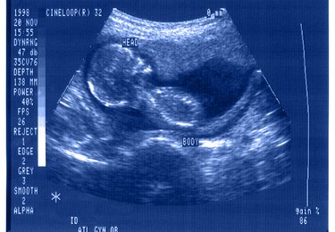 fot. mat. Muzeum Sztuki w Łodzi