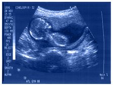 fot. mat. Muzeum Sztuki w Łodzi